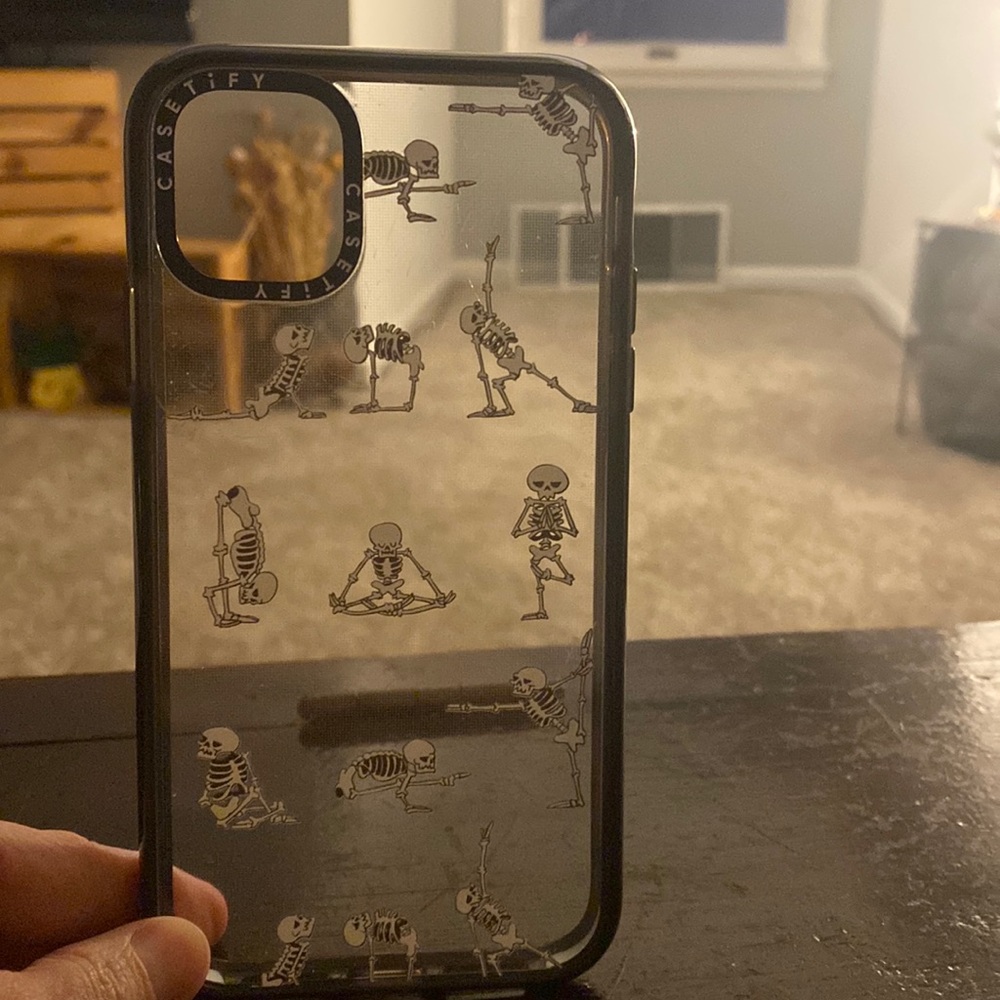 Casetify Skeleton Yoga case